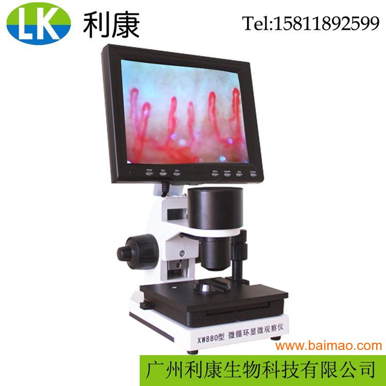 高清xw880微循环检测仪 末梢血管观察仪